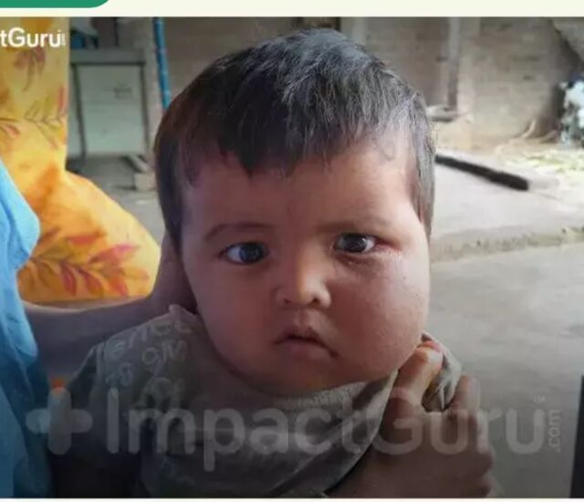 Tanish's Head Swells With Pain Every Day; He Needs Surgery To Survive